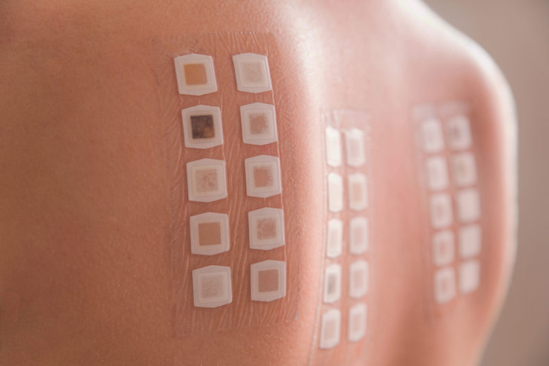 Allergy Patch Testing Dermatology Specialists Of Spokane